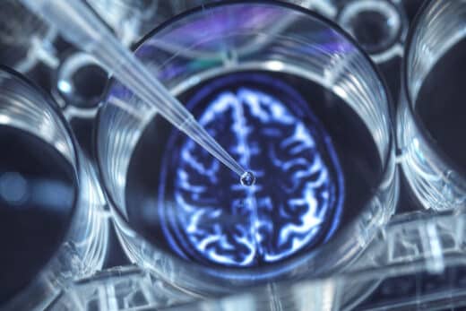 Fda Approved Antidepressant Shows Promise Treating Incurable Brain Cancer Study Finds