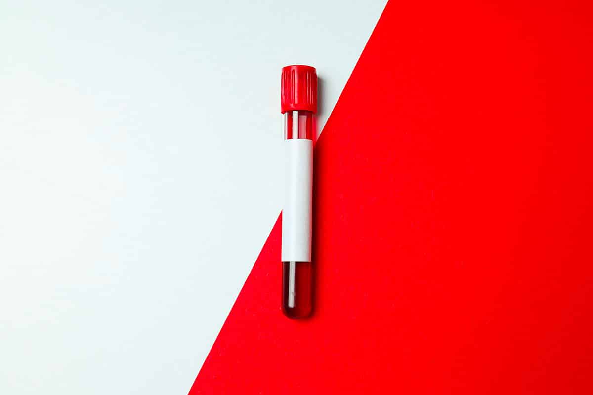 Revolutionary Blood Test Detects Cancers Symptoms Appear Breakthrough Early Diagnosis